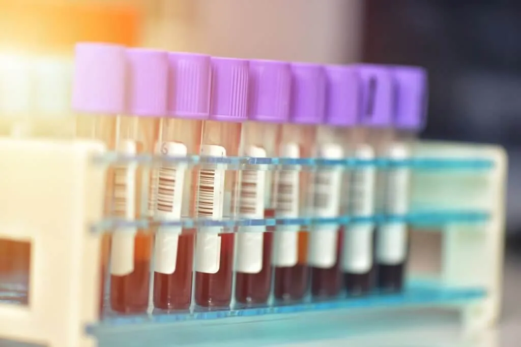 Robot to transport blood specimens